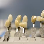 Obecna technika używana w salonach stomatologii estetycznej być może spowodować, że odzyskamy ładny uśmieszek.